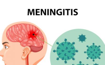 🏂เยื่อหุ้มสมองอักเสบ Meningitis