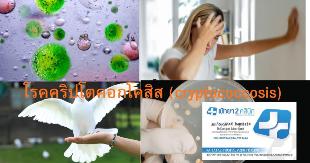 ติดเชื้อระบบประสาท