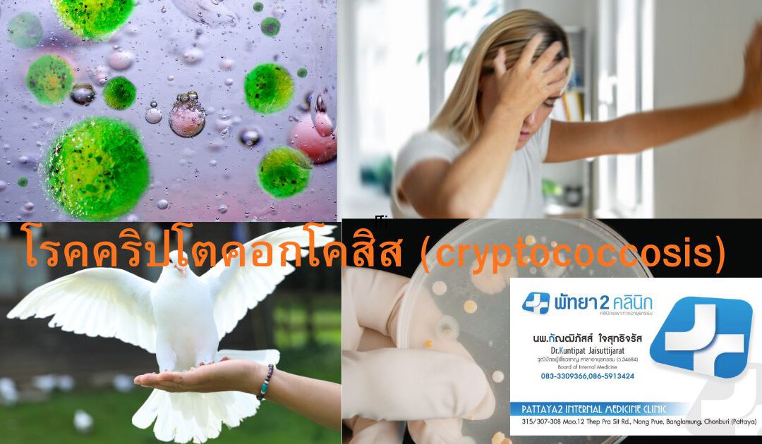 เยื่อหุ้มสมองอักเสบจากเชื้อรา Cryptococcus (Cryptococcal Meningitis)