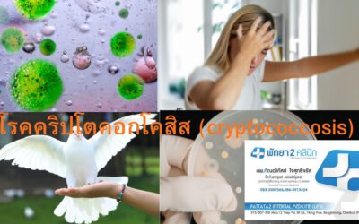 เยื่อหุ้มสมองอักเสบจากเชื้อรา Cryptococcus (Cryptococcal Meningitis)