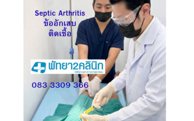 ระวัง! เข่าบวมอักเสบเฉียบพลัน อาจไม่ใช่แค่เรื่อง “ข้อ” แต่เป็นสัญญาณเตือนจากโรคติดต่อ