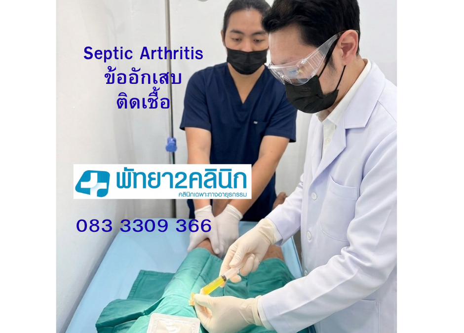 ข้ออักเสบ เจาะเข่า arthocenchesis