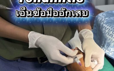 ⚠️ ปวดข้อมือเรื้อรังจากการยกของหนัก! รับมือภาวะเอ็นข้อมืออักเสบ (De Quervain’s Tenosynovitis) ในวัย 40+
