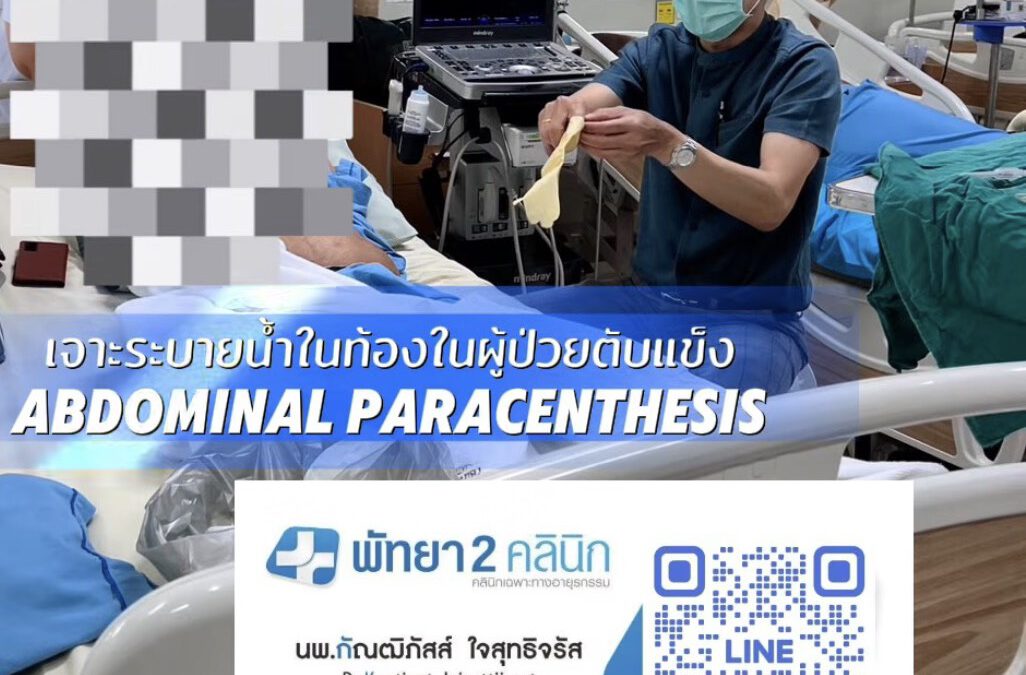 ตับแข็ง ไวรัสตับอักเสบบี ซี เอ